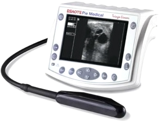 ESAOTE 超音波画像診断装置 トリンガ リニア VET バッテリーセル交換